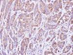 MOK Antibody in Immunohistochemistry (Paraffin) (IHC (P))
