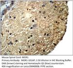 MOR1 Polyclonal Antibody