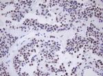MORF4 Antibody in Immunohistochemistry (Paraffin) (IHC (P))