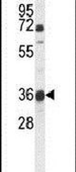 MOSC1 Antibody in Western Blot (WB)