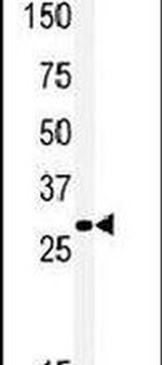 MOX1 Antibody in Western Blot (WB)