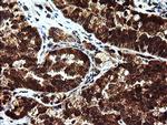 MPI Antibody in Immunohistochemistry (Paraffin) (IHC (P))