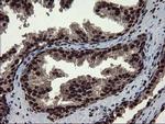 MPI Antibody in Immunohistochemistry (Paraffin) (IHC (P))