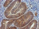 MPI Antibody in Immunohistochemistry (Paraffin) (IHC (P))