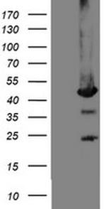MPI Antibody in Western Blot (WB)