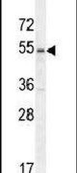 MPP1 Antibody in Western Blot (WB)