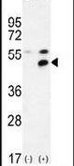 MPP1 Antibody in Western Blot (WB)