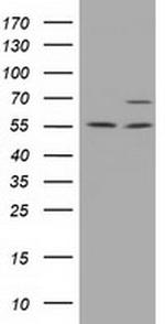 MPP3 Antibody in Western Blot (WB)