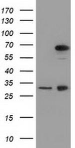 MPP3 Antibody in Western Blot (WB)