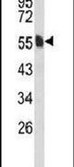 VAM1 Antibody in Western Blot (WB)