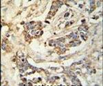 MRAP Antibody in Immunohistochemistry (IHC)