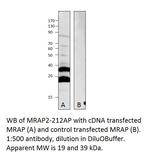 MRAP2 Polyclonal Antibody
