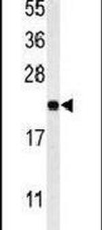 MRAP Antibody in Western Blot (WB)