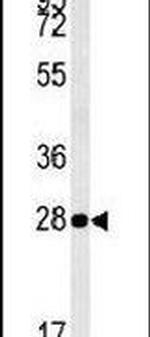 MRM1 Antibody in Western Blot (WB)