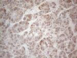 MRPL10 Antibody in Immunohistochemistry (Paraffin) (IHC (P))