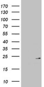 MRPL13 Antibody in Western Blot (WB)