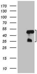 MRPL15 Antibody in Western Blot (WB)