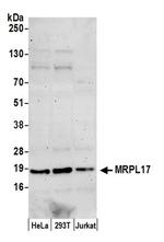 MRPL17 Polyclonal Antibody
