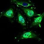 MRPL42 Monoclonal Antibody (3H6G11)