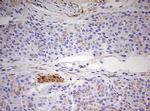 MRPS11 Antibody in Immunohistochemistry (Paraffin) (IHC (P))