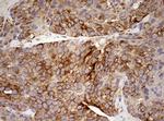 MRPS11 Antibody in Immunohistochemistry (Paraffin) (IHC (P))