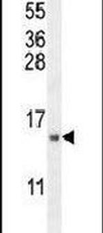 MRPS24 Antibody in Western Blot (WB)