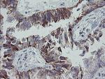 MRPS27 Antibody in Immunohistochemistry (Paraffin) (IHC (P))