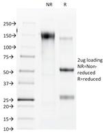 Connexin 32 (Gap Junction Protein) Monoclonal Antibody (R5.21C)