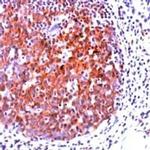 CD20 Antibody in Immunohistochemistry (IHC)