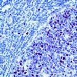 MSH2 Antibody in Immunohistochemistry (IHC)