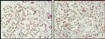 MSH2 Antibody in Immunohistochemistry (Paraffin) (IHC (P))