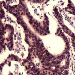 MSH2 Antibody in Immunohistochemistry (IHC)