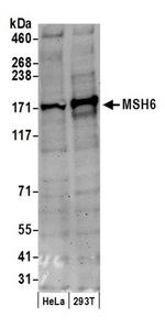 MSH6 Antibody in Western Blot (WB)