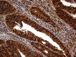 MSH6 Antibody in Immunohistochemistry (Paraffin) (IHC (P))
