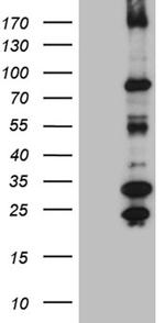MSH6 Antibody in Western Blot (WB)