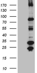 MSH6 Antibody in Western Blot (WB)