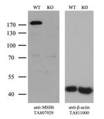 MSH6 Antibody in Western Blot (WB)