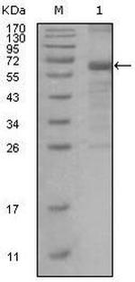 MSH6 Monoclonal Antibody (3A10H7)