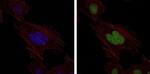MSH6 Monoclonal Antibody (3E1)