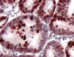 MSH6 Antibody in Immunohistochemistry (Paraffin) (IHC (P))