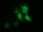 MSI1 Antibody in Immunocytochemistry (ICC/IF)
