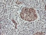 MSI1 Antibody in Immunohistochemistry (Paraffin) (IHC (P))