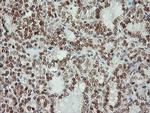 MSI1 Antibody in Immunohistochemistry (Paraffin) (IHC (P))