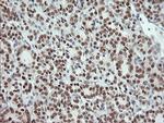 MSI1 Antibody in Immunohistochemistry (Paraffin) (IHC (P))