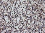 MSI1 Antibody in Immunohistochemistry (Paraffin) (IHC (P))