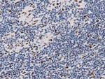 MSI1 Antibody in Immunohistochemistry (Paraffin) (IHC (P))
