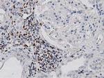 MSI1 Antibody in Immunohistochemistry (Paraffin) (IHC (P))
