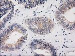 MSI1 Antibody in Immunohistochemistry (Paraffin) (IHC (P))