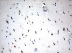 MSI1 Antibody in Immunohistochemistry (Paraffin) (IHC (P))