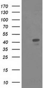 MSI1 Antibody in Western Blot (WB)